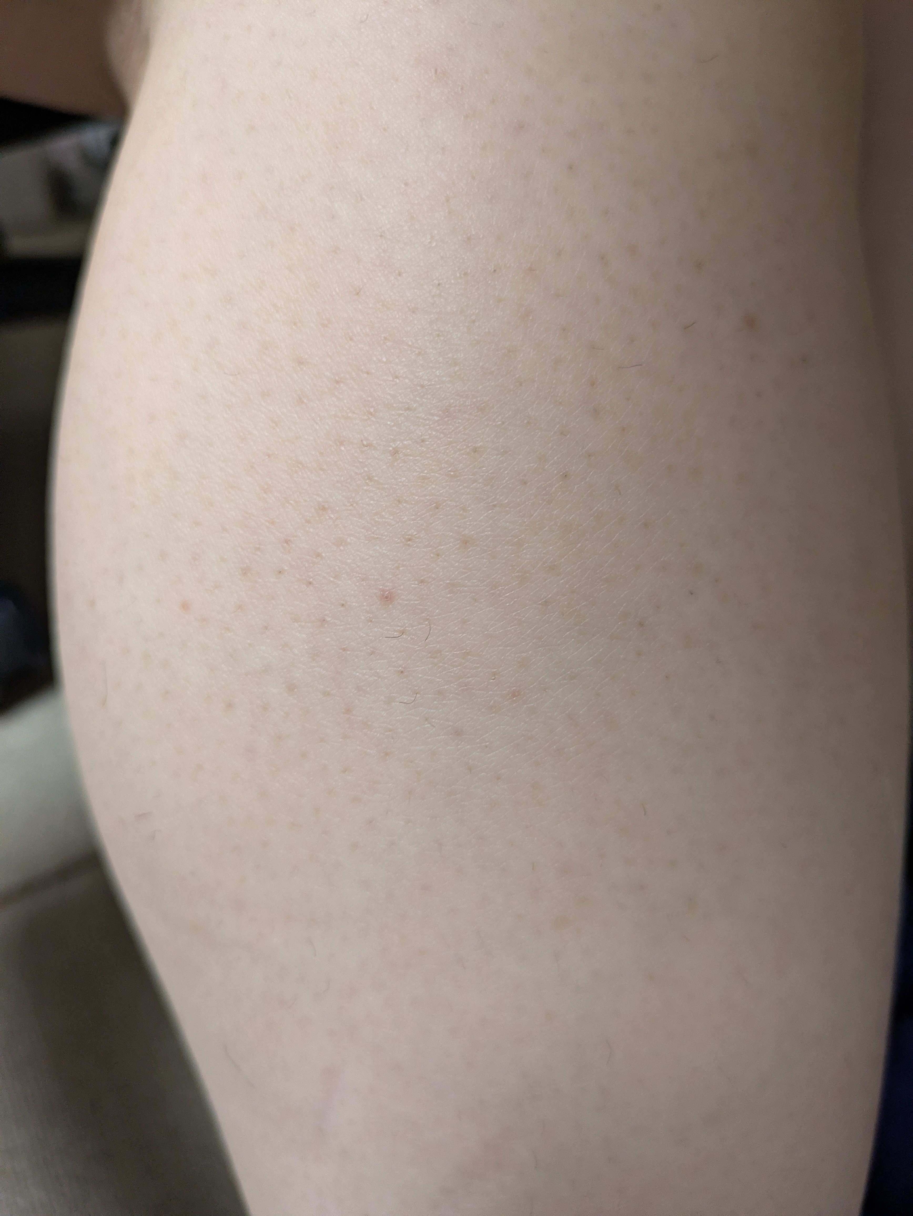 脚まわりの記録用に撮った写真（個人のメモ）