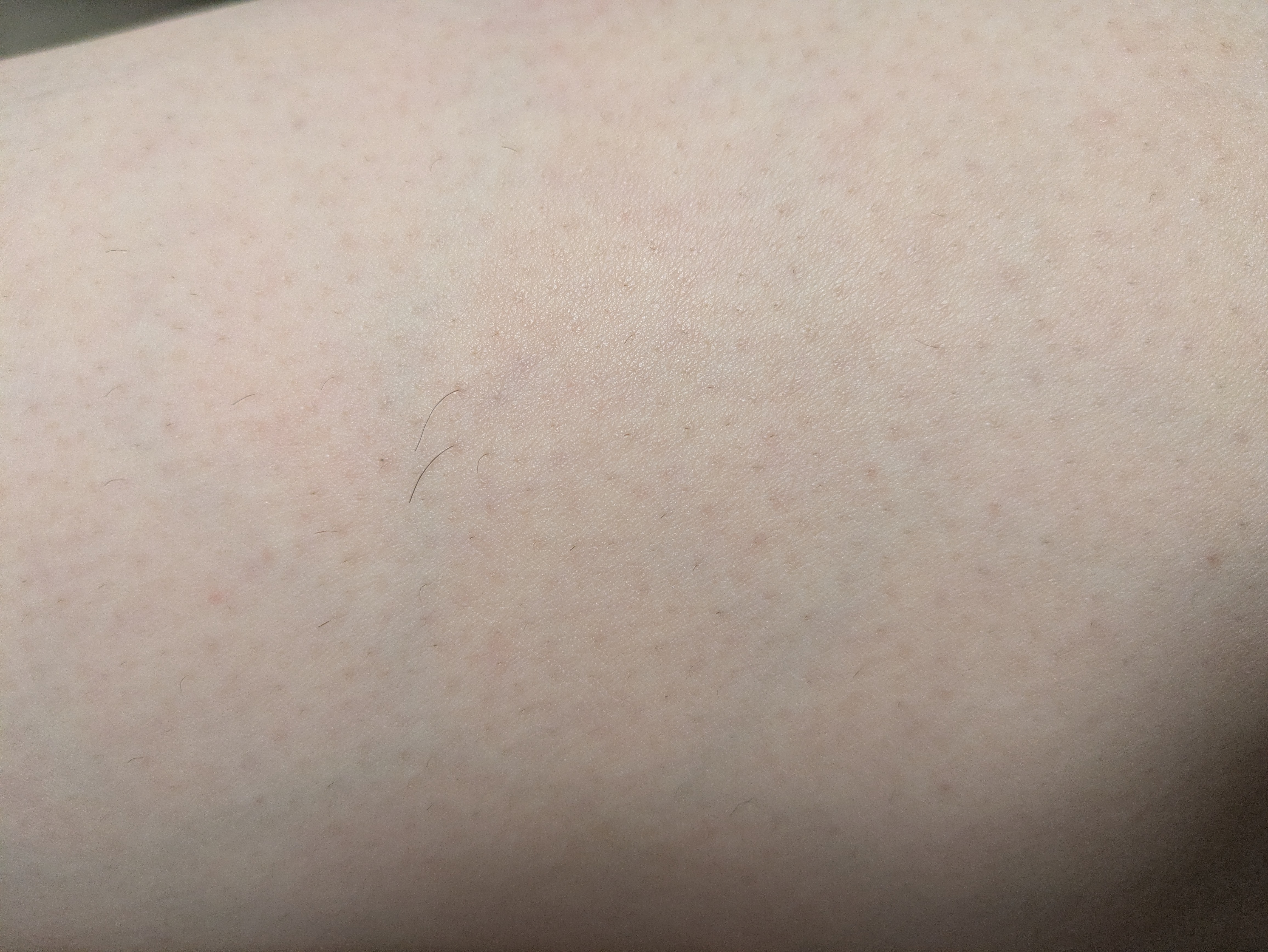 脚まわりの記録用に撮った写真(個人のメモ)